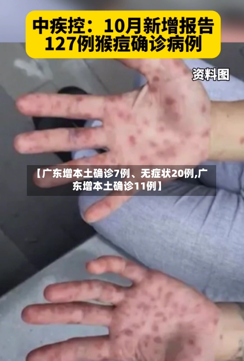 【广东增本土确诊7例、无症状20例,广东增本土确诊11例】-第3张图片